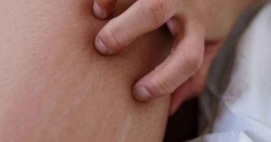 Hilft Tallow bei Ekzemen