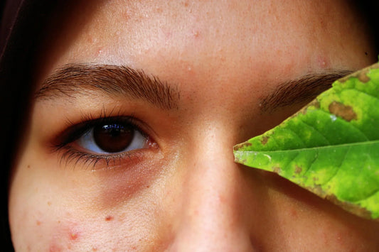 Skin Purging: Was es ist und warum es bei EAT Skincare vorkommen kann